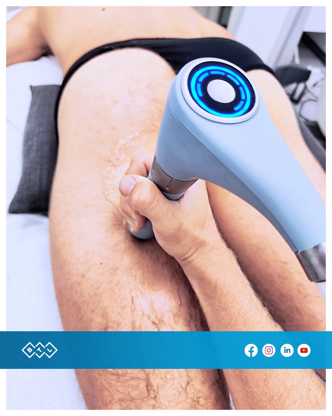 Shockwave therapy for proximal hamstring tendinopathy — SportsFit Health and Rehab Five Dock
